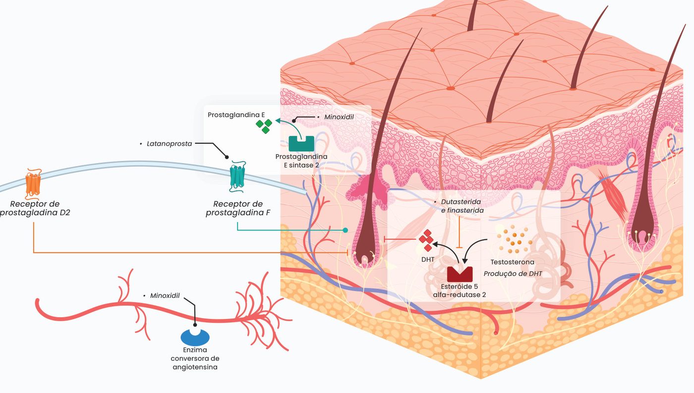 Figura 2: o minoxidil atua sobre a enzima conversora de angiotensina e a prostaglandina E sintase 2; a latanoprosta atua no receptor de prostaglandina F; dutasterida e finasterida inibem a esteroide 5-alfa-redutase 2, que converte testosterona em DHT; o receptor de prostaglandina D2 também participa do processo