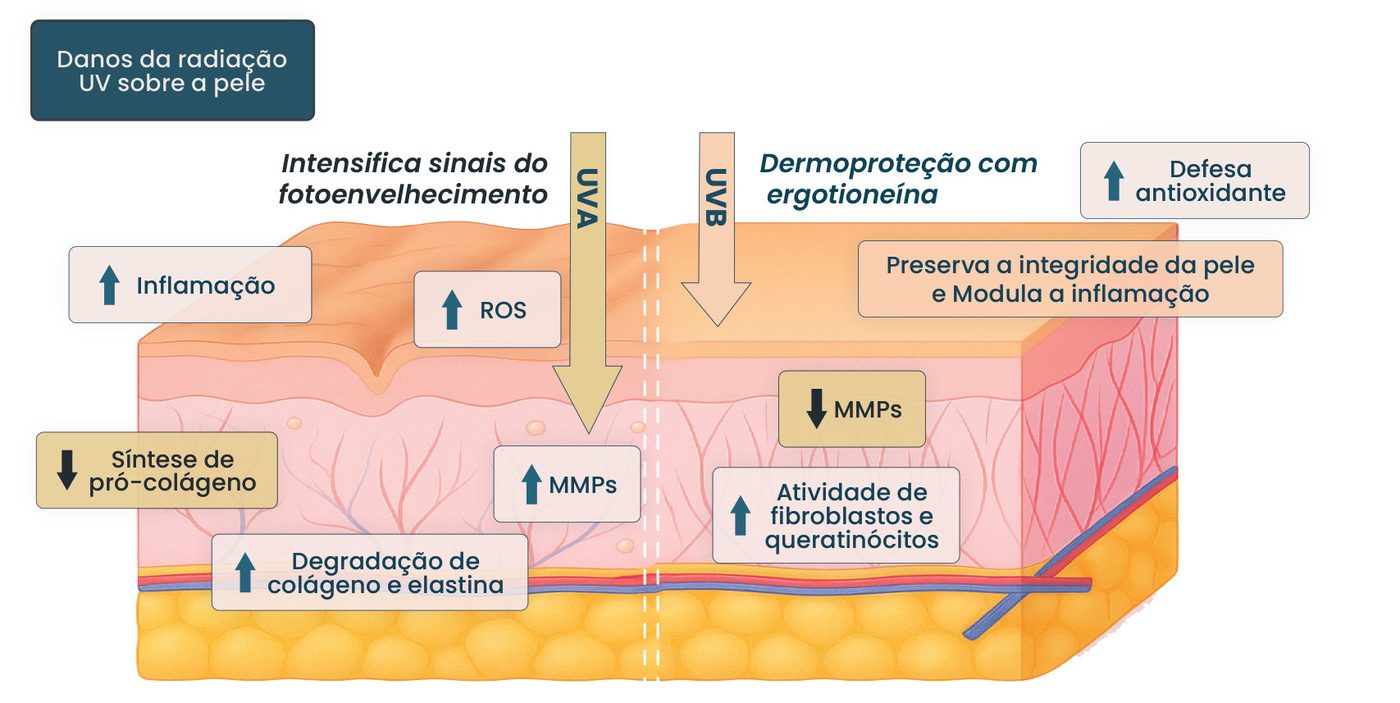 Figura 1: danos da radiação UV sobre a pele. Sem proteção, UVA e UVB intensificam os sinais do fotoenvelhecimento: aumentam inflamação, ROS, MMPs e degradação de colágeno e elastina, e reduzem a síntese de pró-colágeno. Com a dermoproteção da ergotioneína, aumentam a defesa antioxidante e a atividade de fibroblastos e queratinócitos, reduzem as MMPs, preservando a integridade da pele e modulando a inflamação