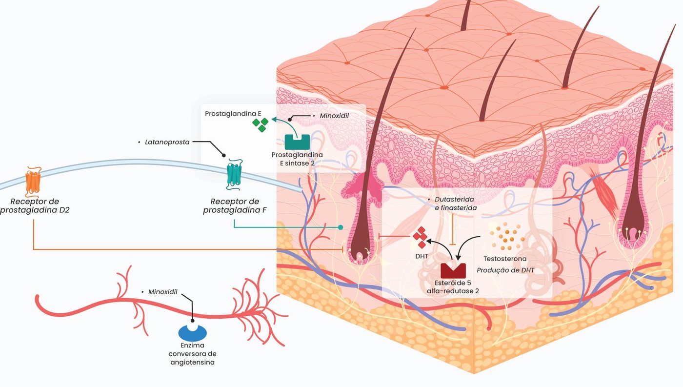 Figura 2: o minoxidil atua sobre a enzima conversora de angiotensina e a prostaglandina E sintase 2; a latanoprosta atua no receptor de prostaglandina F; dutasterida e finasterida inibem a esteroide 5-alfa-redutase 2, que converte testosterona em DHT; o receptor de prostaglandina D2 também participa do processo