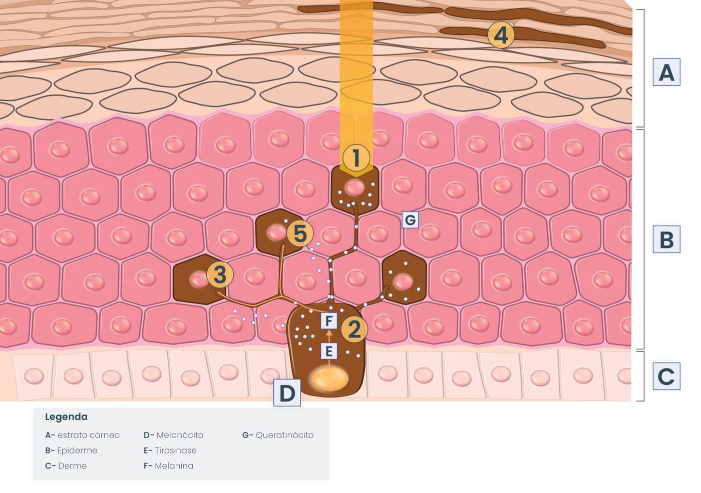 Figura 1: corte da pele com estrato córneo (A), epiderme (B) e derme (C). O raio UV (1) atinge os queratinócitos (G), gera radicais livres que afetam o melanócito (D), onde a tirosinase (E) forma melanina (F) (2 e 3); a melanina é transferida (5) e eliminada na esfoliação da camada superficial (4)