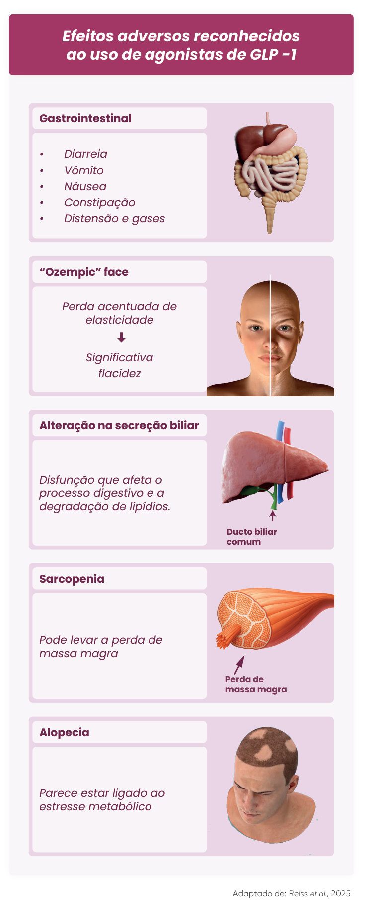 Figura 1: efeitos adversos reconhecidos dos agonistas de GLP-1: gastrointestinais (diarreia, vômito, náusea, constipação, distensão e gases); Ozempic face (perda acentuada de elasticidade e flacidez significativa); alteração na secreção biliar (afeta digestão e degradação de lipídios); sarcopenia (perda de massa magra); e alopecia (ligada ao estresse metabólico)