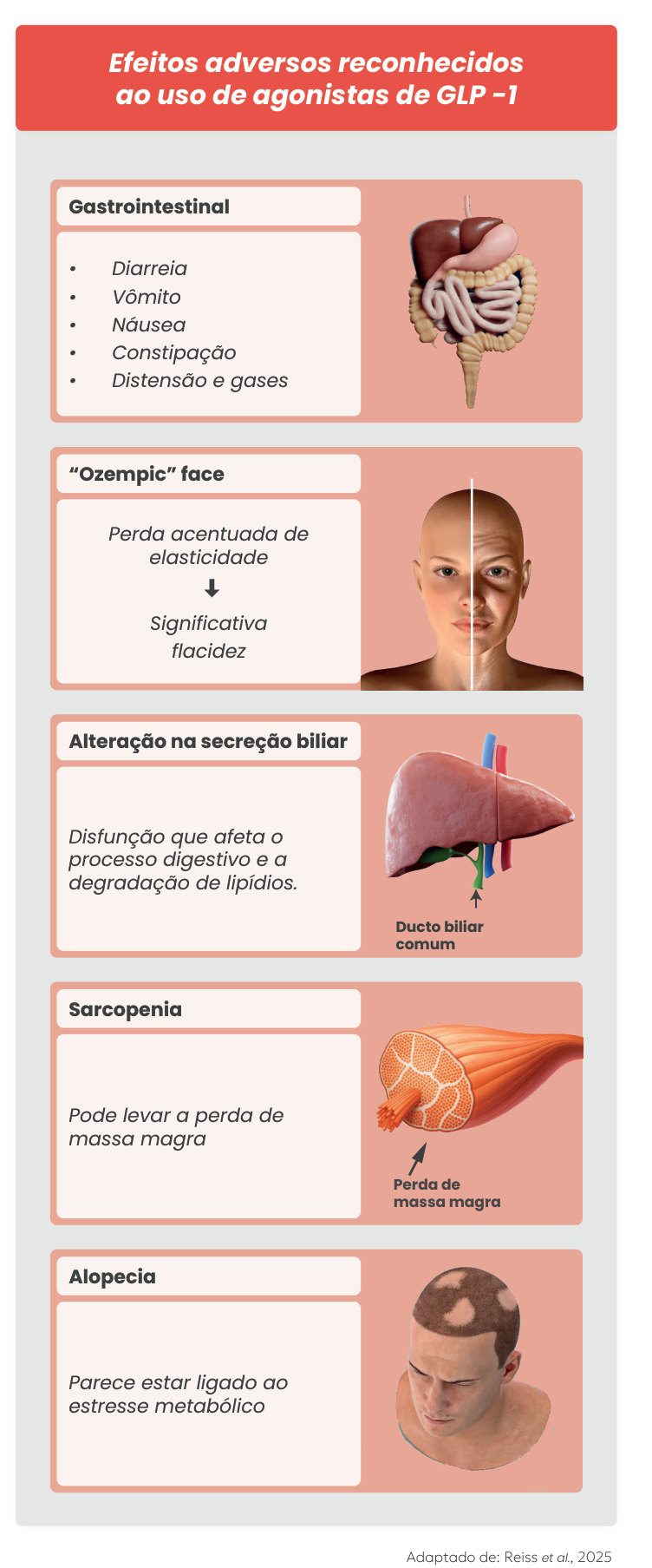 Figura 1: efeitos adversos reconhecidos dos agonistas de GLP-1: gastrointestinais (diarreia, vômito, náusea, constipação, distensão e gases); Ozempic face (perda acentuada de elasticidade e flacidez significativa); alteração na secreção biliar (afeta digestão e degradação de lipídios); sarcopenia (perda de massa magra); e alopecia (ligada ao estresse metabólico)