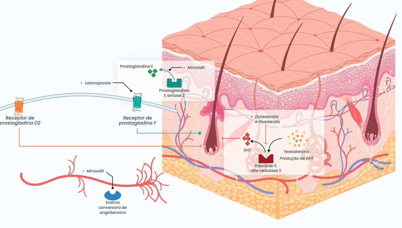 Figura 2: o minoxidil atua sobre a enzima conversora de angiotensina e a prostaglandina E sintase 2; a latanoprosta atua no receptor de prostaglandina F; dutasterida e finasterida inibem a esteroide 5-alfa-redutase 2, que converte testosterona em DHT; o receptor de prostaglandina D2 também participa do processo